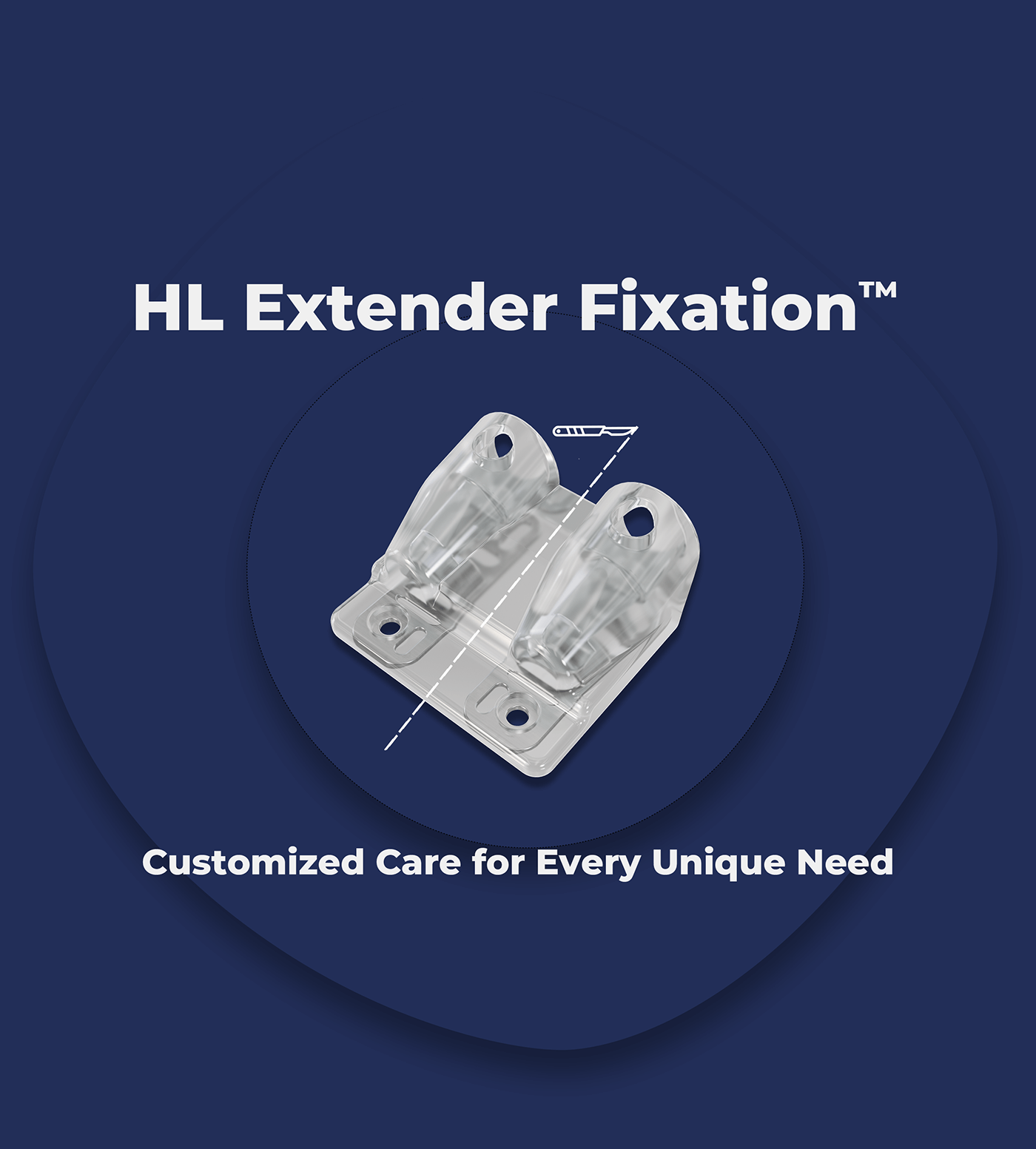 HL Extender Fixation